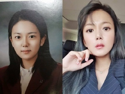 【比較写真】“整形疑惑”の韓国美人女優がビフォーアフター写真で釈明…「あごはしてない」