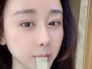 “二重整形”後に自撮りアップの韓国お騒がせタレント、その美しさにウットリ【PHOTO】