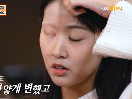 韓国のお悩み解決番組に“顔半分が真っ白”の日本人女性が登場…出演者が告げたアドバイスとは？