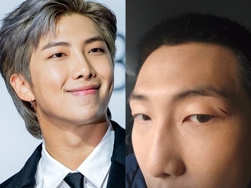 【写真】BTS・RM、左目の上に“深い傷”を負う…本人は涙のイラストで痛みを表現、ファンの心配の声続く