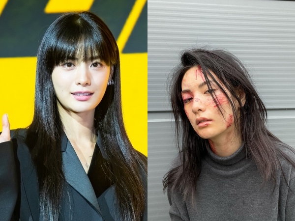 世界1位の韓国女優ナナ、腫れ上がった片目に血だらけの顔…一体何が？【PHOTO】