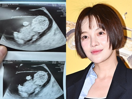 『キム秘書』出演女優、エコー写真で第一子妊娠を発表！昨年に俳優ハ・ジョンウ実弟と結婚【全文】