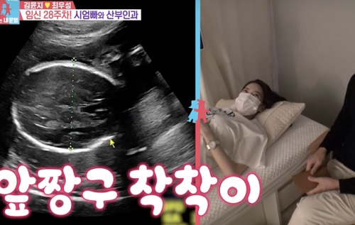 超音波で赤ちゃんを見せるキム・ユンジ