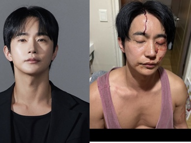 「性病をうつされ暴力もあった」と告発された韓国俳優が反論「彼女に殴られた」