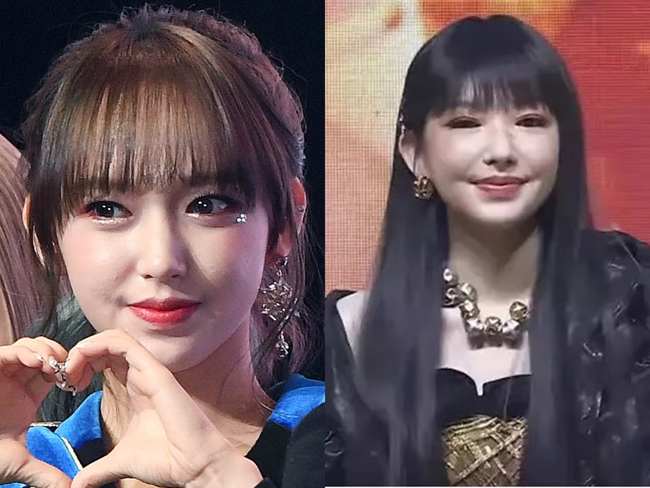 整形失敗？あの美少女が…大きく変わったビジュアルでファンを驚かせた元K-POPアイドル、原因とは