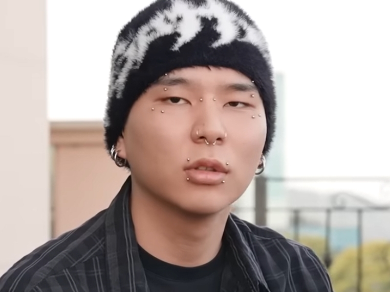 7針縫って撮影を再開」IVE・ウォニョン、MV撮影時に負傷していた…怒り