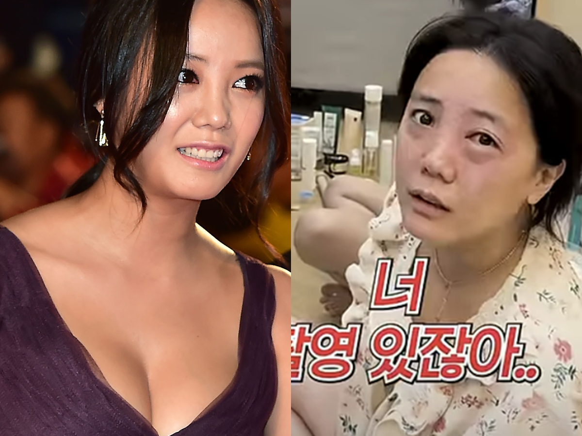 顔面トラブル続きの韓国女優、今度は異常な目の腫れに困惑「撮影直前に緊急事態」