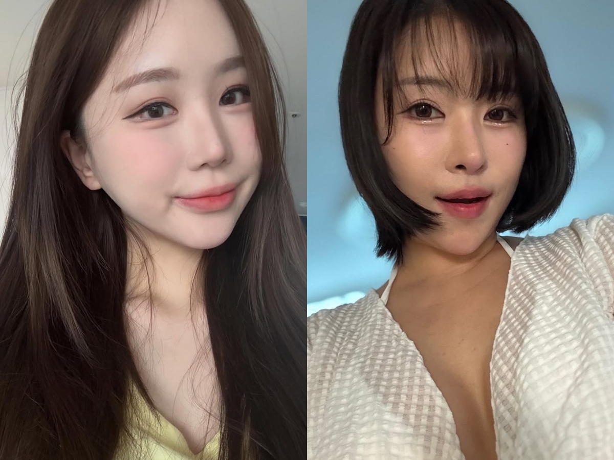 「整形してもブス」“元カレは日本人”の韓国豊胸芸人と、中2から整形のユーチューバーが語る「顔を変えたメリット」