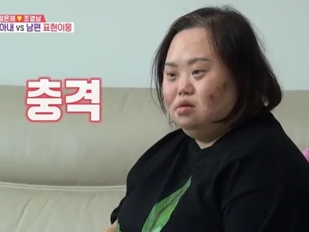 韓国のダウン症女優、夫にキスを迫るも拒まれる　性教育講師から“拒否の仕方”を学ぶ場面が話題