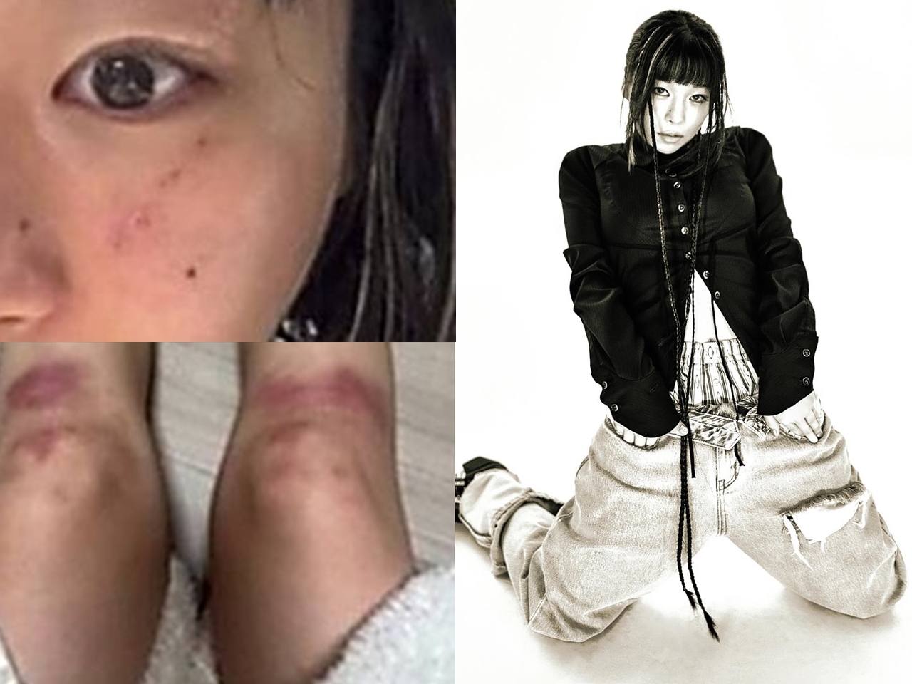 ボコボコに殴られたような写真はなんだったのか…元恋人のDV疑惑を提起した韓国女性ラッパー、立場を翻す